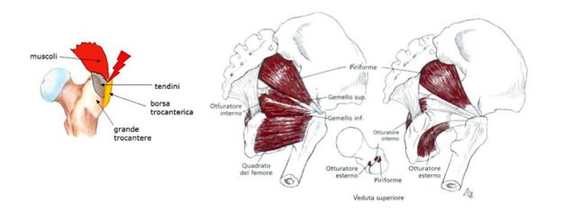 Trocanterite E Sindrome Del Piriforme Fisiopodos